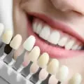 How Can Cosmetic Dentistry Improve Your Smile
